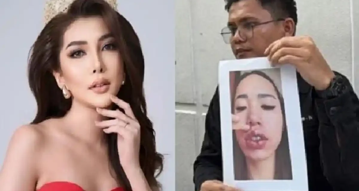 Jeni Rahmadial Fitri: Putri Indonesia Riau Terseret Kasus Pelakor